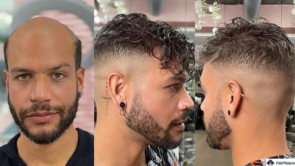 Haarersatzsysteme für Männer – Expertenbewertung zu Toupet, Haarteil und Perücke